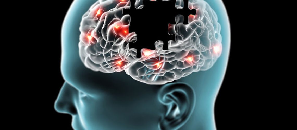 parkinson
